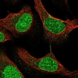 SMIM13 Antibody, Novus Biologicals 25 &mu;L, Unlabeled:Antibodies, Polyclonal
